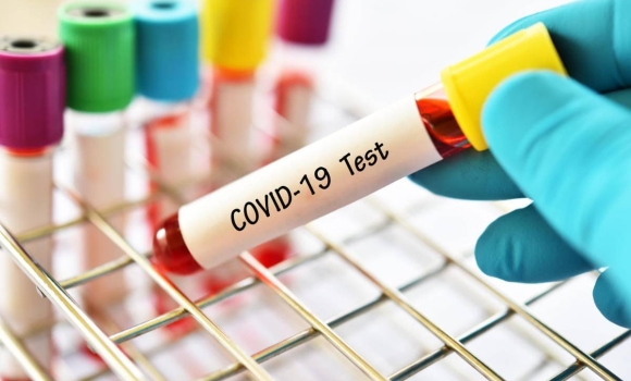 На Вінниччині за добу, 18 січня, ще 24 людини захворіли на коронавірус