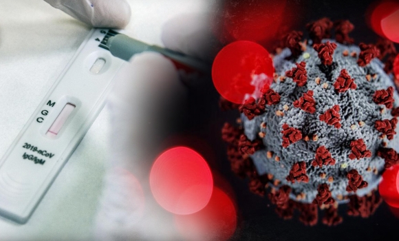 Вінниця отримала 41 тисячу швидких тестів на коронавірус