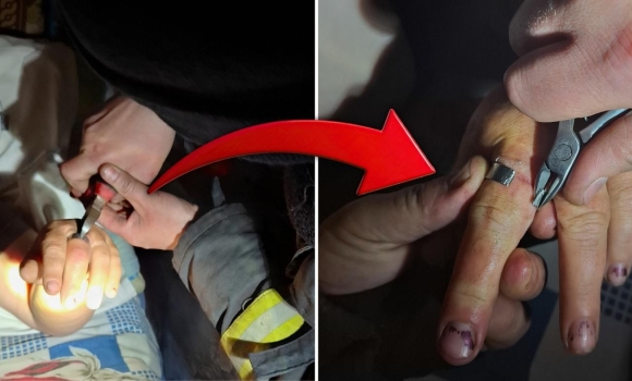 Замість каблучки — шайба вінницькі рятувальники визволяли жінку з металевого «полону» Замість каблучки — шайба вінницькі рятувальники визволяли жінку з металевого «полону»