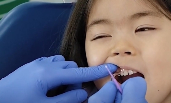 Дитина під наркозом: як спокійно лікувати дитячі зубки